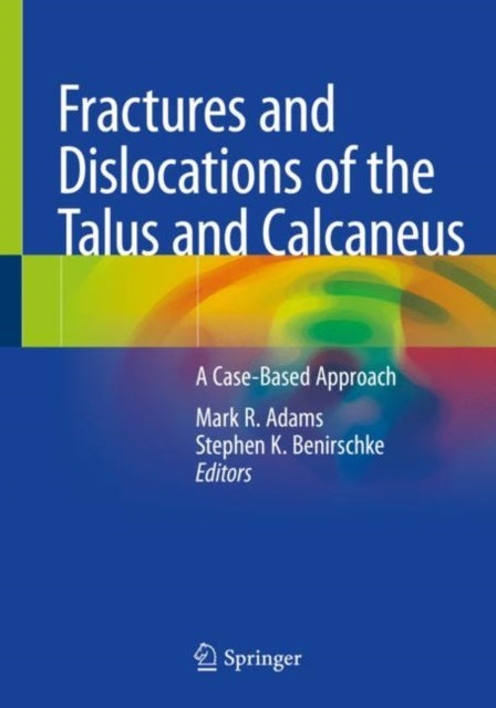 Book cover of: Fractures and Dislocations of the Talus and Calcaneus. By: Mark R. Adams
