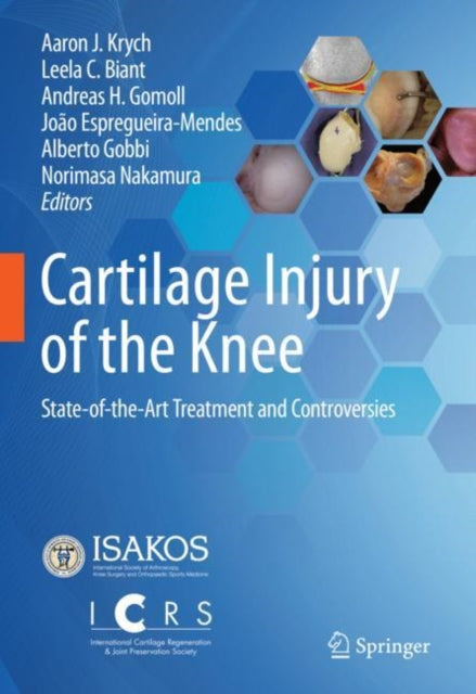 Book cover of: Cartilage Injury of the Knee. By: Aaron J. Krych