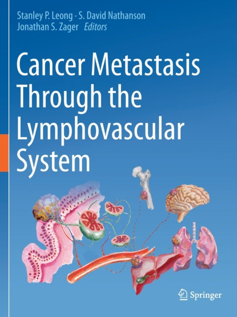 Book cover of: Cancer Metastasis Through the Lymphovascular System. By: Stanley P. Leong