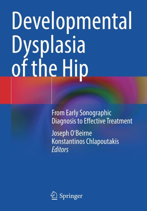 Developmental Dysplasia of the Hip