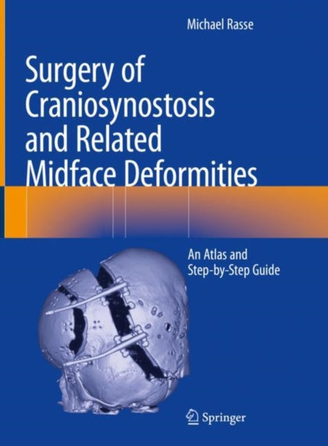 Book cover of: Surgery of Craniosynostosis and Related Midface Deformities. By: Michael Rasse