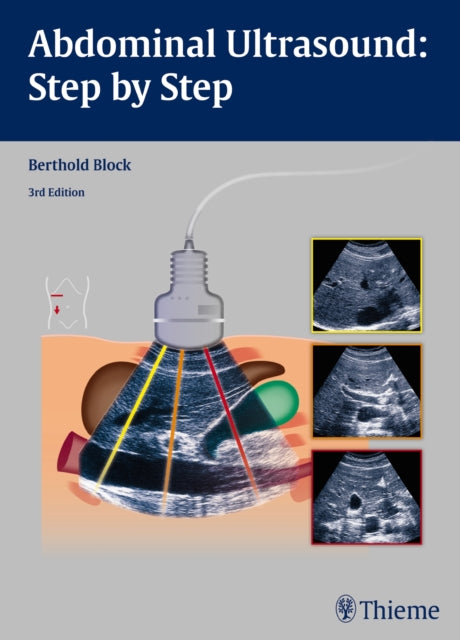 Book cover of: Abdominal Ultrasound: Step by Step. By: Berthold Block