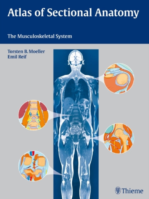 Book cover of: Atlas of Sectional Anatomy. By: Torsten B. Möller