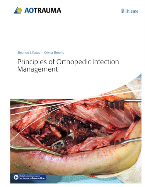 Book cover of: Principles of Orthopedic Infection Management. By: Stephen L. Kates