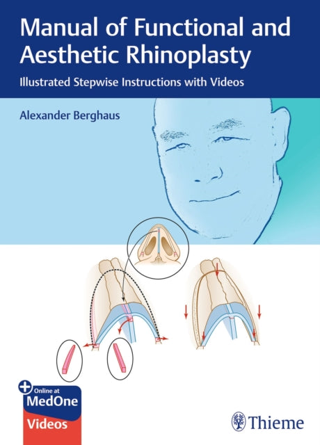 Book cover of: Manual of Functional and Aesthetic Rhinoplasty. By: Alexander Berghaus