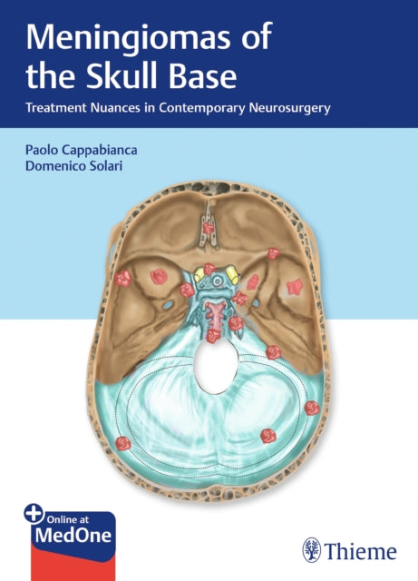 Book cover of: Meningiomas of the Skull Base. By: Paolo Cappabianca
