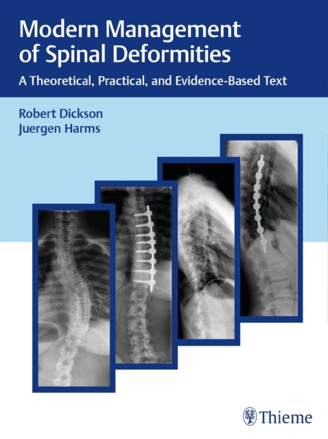 Book cover of: Modern Management of Spinal Deformities. By: Robert A. Dickson