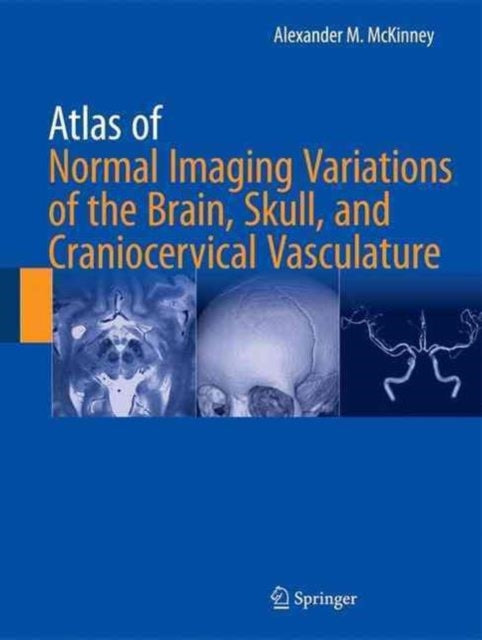 Book cover of: Atlas of Normal Imaging Variations of the Brain, Skull, and Craniocervical Vasculature. By: Alexander M. McKinney