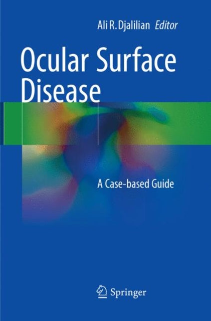 Book cover of: Ocular Surface Disease. By: Ali R. Djalilian