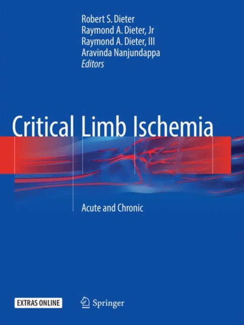 Book cover of: Critical Limb Ischemia. By: Robert S. Dieter