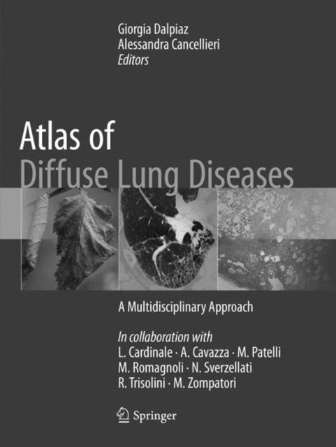 Book cover of: Atlas of Diffuse Lung Diseases. By: Giorgia Dalpiaz