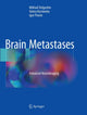 Book cover of: Brain Metastases. By: Mikhail Dolgushin
