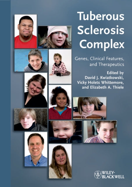 Book cover of: Tuberous Sclerosis Complex. By: David J. Kwiatkowski
