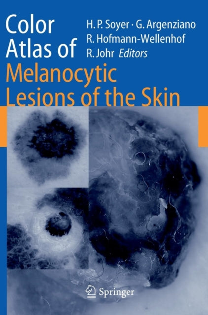 Book cover of: Color Atlas of Melanocytic Lesions of the Skin