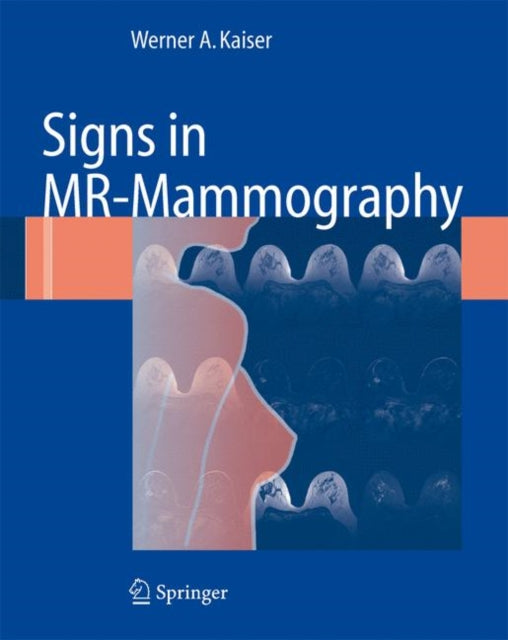 Book cover of: Signs in MR-Mammography. By: Werner A. Kaiser