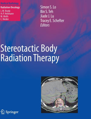 Stereotactic Body Radiation Therapy