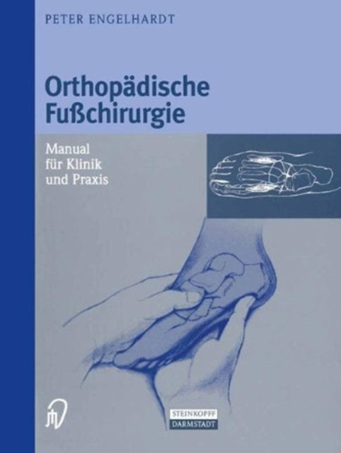 Book cover of: Orthopadische Fuchirurgie