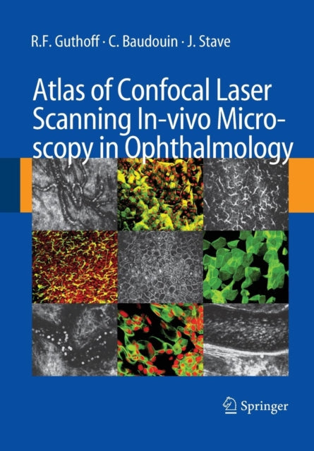 Book cover of: Atlas of Confocal Laser Scanning In-vivo Microscopy in Ophthalmology. By: R. F. Guthoff