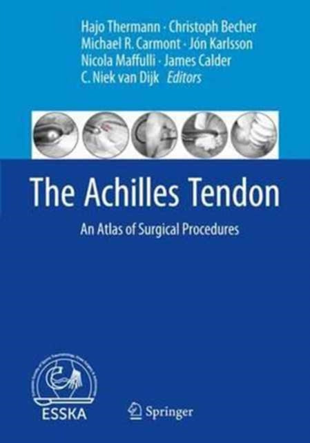Book cover of: Achilles Tendon. By: Hajo Thermann