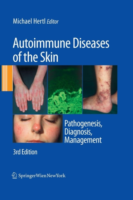 Book cover of: Autoimmune Diseases of the Skin. By: Michael Hertl