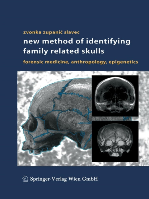 Book cover of: New Method of Identifying Family Related Skulls. By: Zvonka Zupanic Slavec