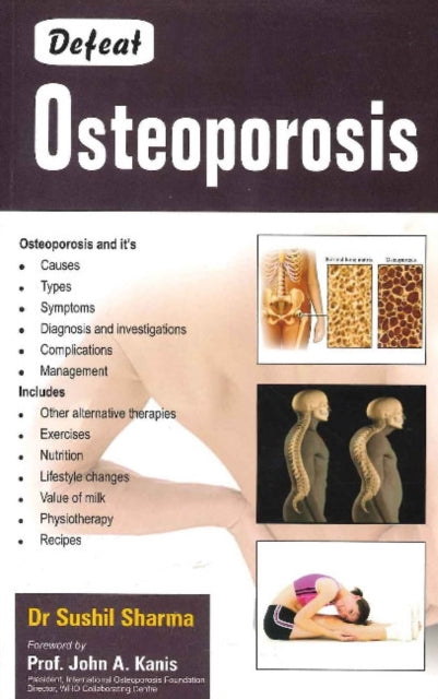 Book cover of: Defeat Osteoporosis