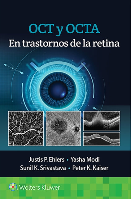 Book cover of: OCT y OCTA en trastornos de la retina. By: Justis P. Ehlers