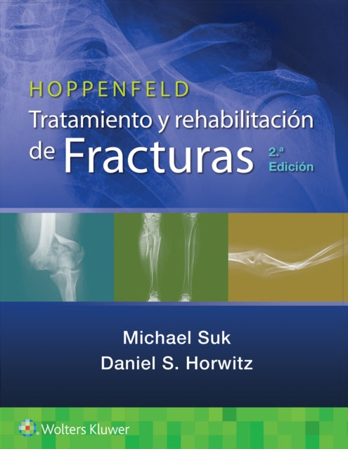 Book cover of: Hoppenfeld. Tratamiento y rehabilitacion de fracturas. By: Michael Suk MD