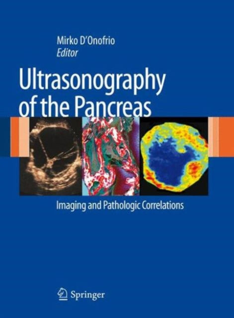 Book cover of: Ultrasonography of the Pancreas