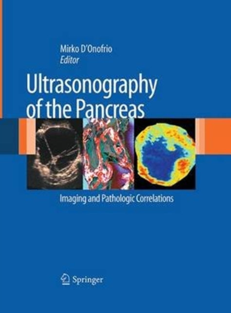 Book cover of: Ultrasonography of the Pancreas. By: Mirko D'Onofrio