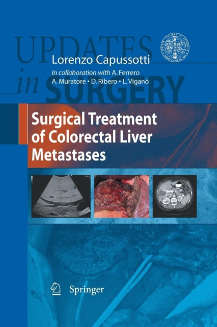 Book cover of: Surgical Treatment of Colorectal Liver Metastases. By: Lorenzo Capussotti