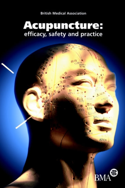 Book cover of: Acupuncture. By: Board of Scienc