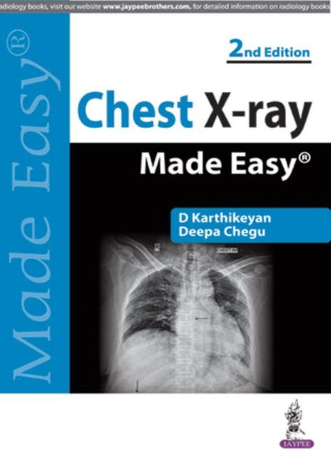 Book cover of: Chest X-ray Made Easy. By: D. Karthikeyan