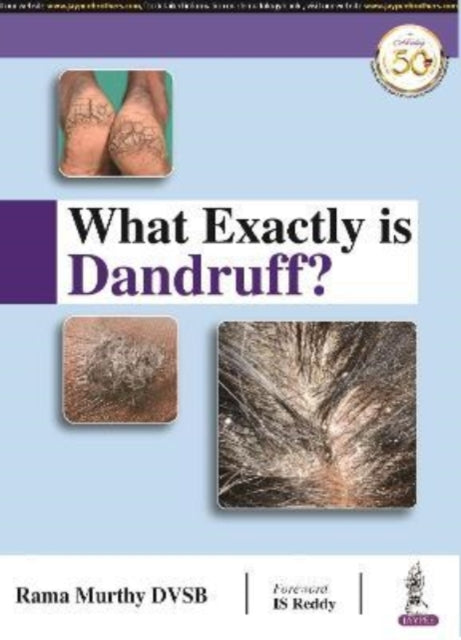 Book cover of: What Exactly is Dandruff?. By: Rama Murthy DVSB