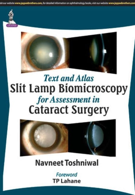 Book cover of: Text and Atlas: Slit Lamp Biomicroscopy for Assessment in Cataract Surgery. By: Navneet Toshniwal