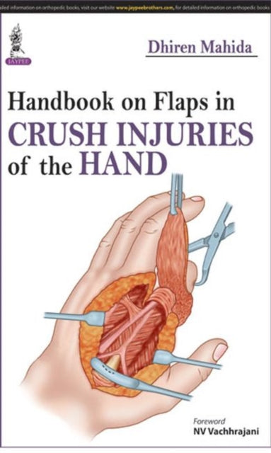 Book cover of: Handbook on Flaps in Crush Injuries of the Hand. By: Dhiren Mahida