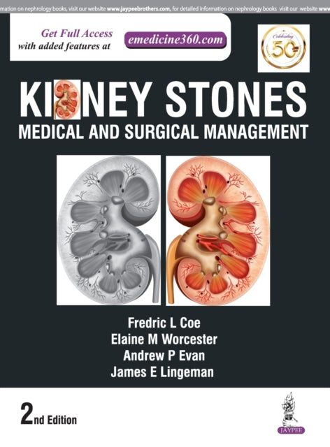 Book cover of: Kidney Stones. By: Fredric Coe