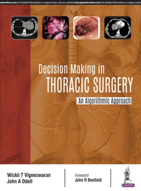 Book cover of: Decision Making in Thoracic Surgery. By: Wickii T. Vigneswaran