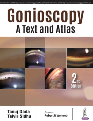 Gonioscopy: A Text and Atlas