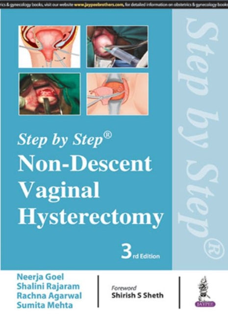 Book cover of: Step by Step: Non-Descent Vaginal Hysterectomy. By: Neerja Goel