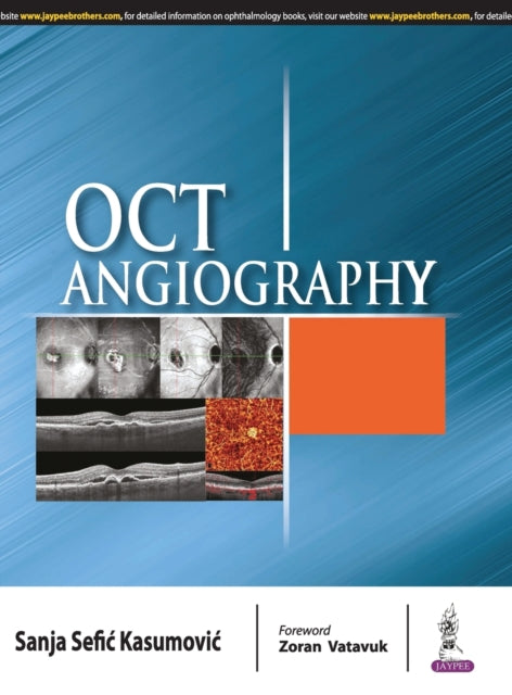 Book cover of: OCT Angiography. By: KASUMOVIC