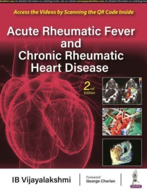Book cover of: Acute Rheumatic Fever and Chronic Rheumatic Heart Disease. By: I. B. Vijayalakshmi