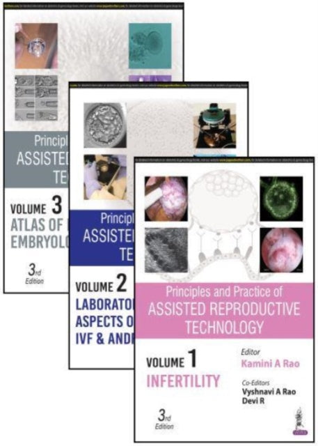Book cover of: Principles and Practice of Assisted Reproductive Technology. By: Kamini A. Rao