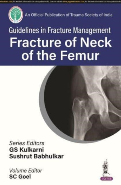 Book cover of: Guidelines in Fracture Management