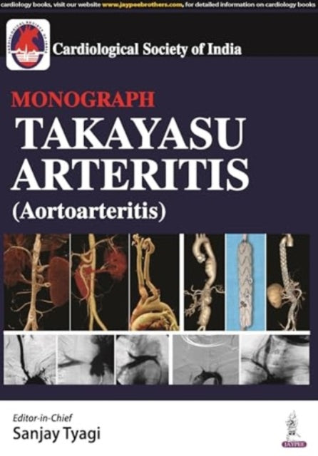 Book cover of: Takayasu Arteritis (Aortoarteritis). By: R. O. Y. TYAGI