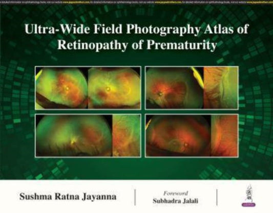 Book cover of: Ultra-Wide Field Photography Atlas of Retinopathy of Prematurity. By: Sushma Ratna Jayanna