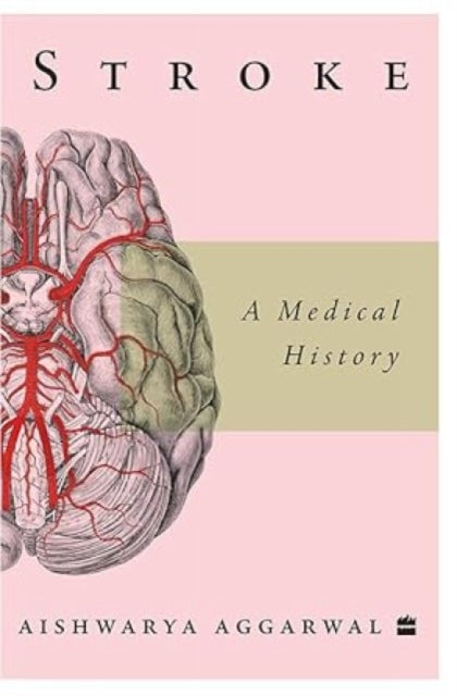 Book cover of: Stroke