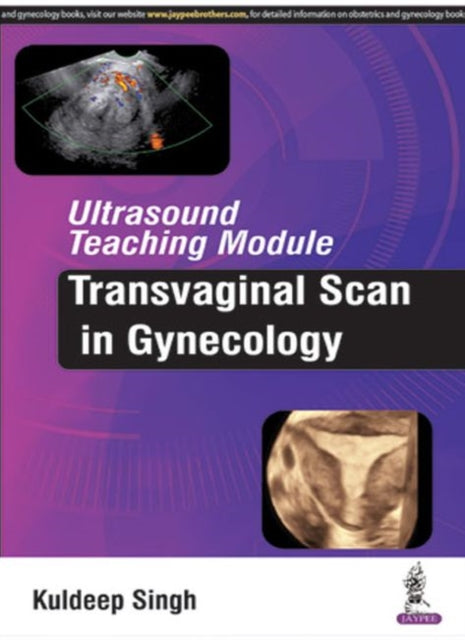 Book cover of: Ultrasound Teaching Module: Transvaginal Scan in Gynecology. By: Kuldeep Singh