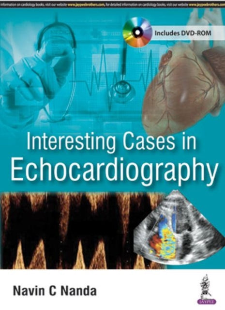 Book cover of: Interesting Cases in Echocardiography. By: Navin C. Nanda