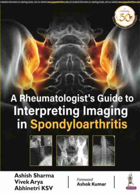 Book cover of: Rheumatologist's Guide to Interpreting Imaging in Spondyloarthritis. By: Ashish Sharma